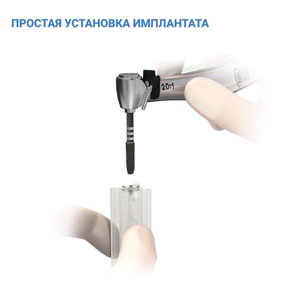 Импланты Astra Tech