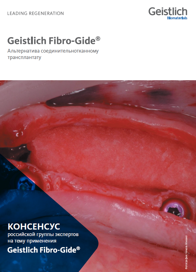 Консенсус Geistlich Fibro-Gide 2021