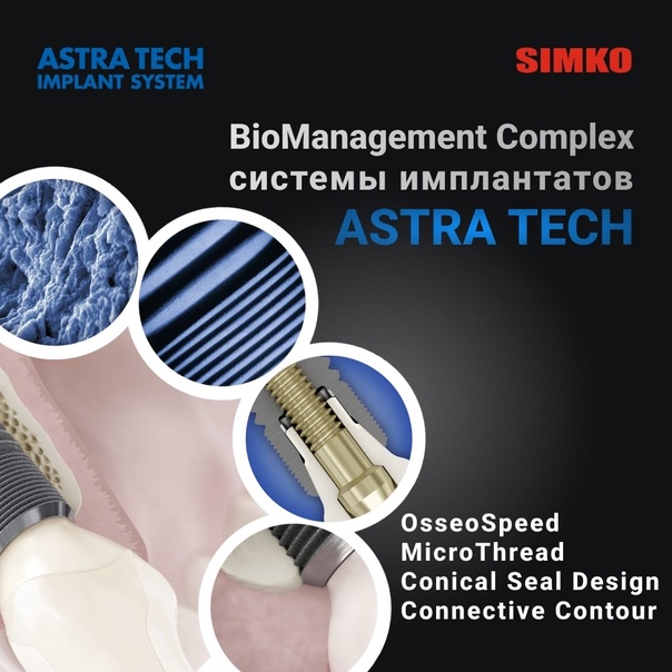 Состав системы BioManagement Complex имплантов Astra Tech