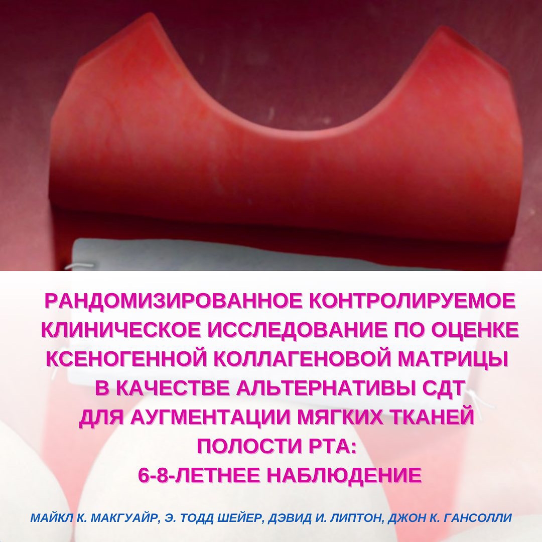3D коллагеновый матрикс vs свободный десневой трансплантат. Данные долгосрочного исследования.
