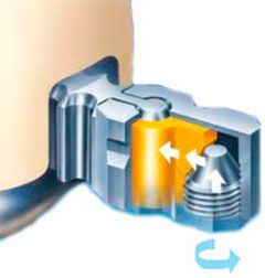 Аттачмен Servo 30"Ti/KST для фиксации съемных зубных протезов, металлический